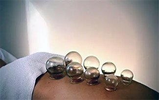 Cupping Cupping