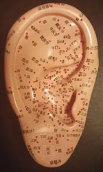 Auricular Acupuncture Auricular Acupuncture